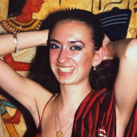 Дівчина з Українка з найбільшими вилицями опублікувала знімки до пластики для порівняння